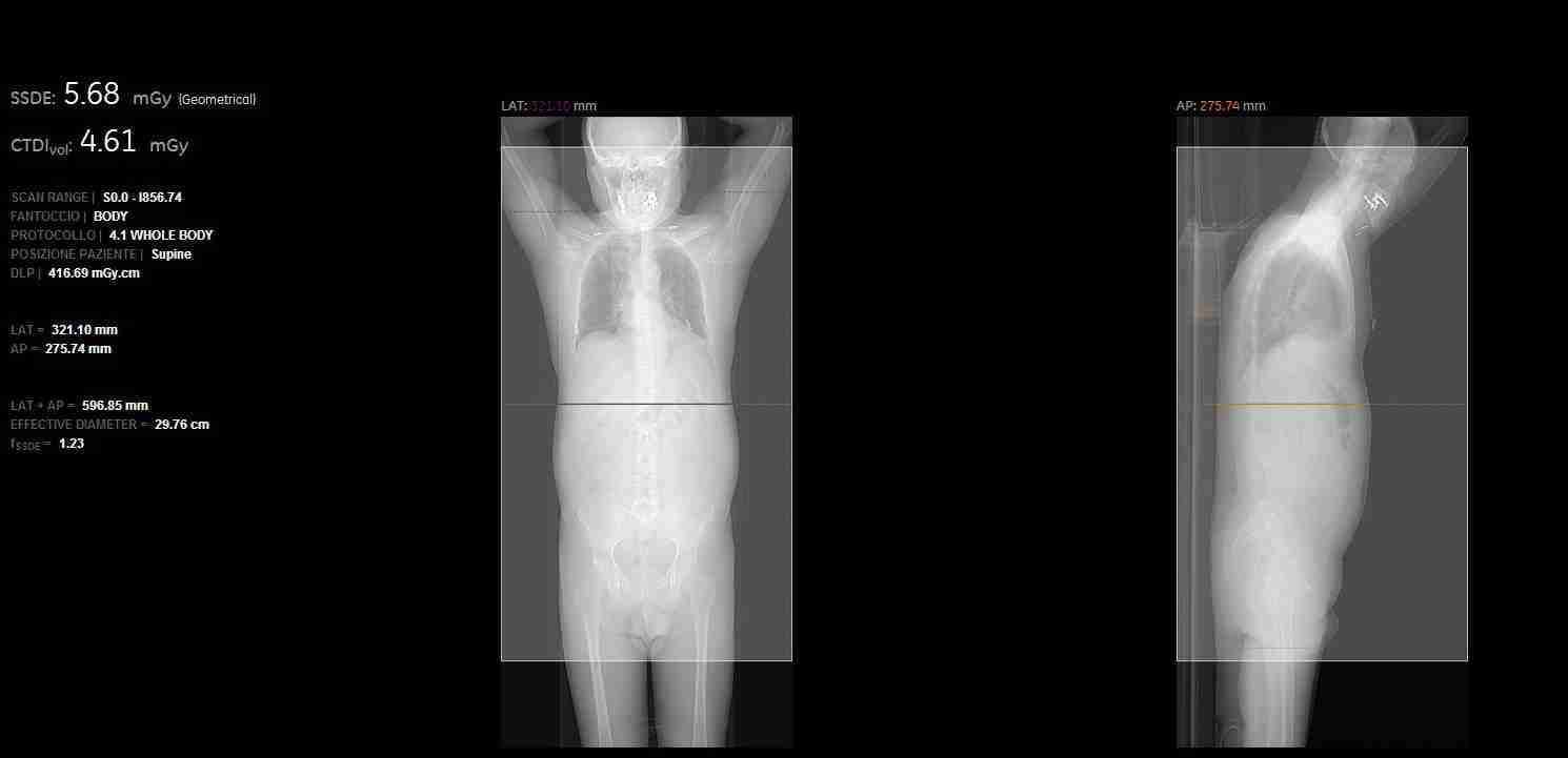 Cannizzaro: Esami radiologici, esposizione sotto controllo